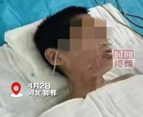 女童被开水烫伤事件：正义的赔偿与反思