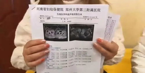 25岁女子怀上九胞胎，决定减胎七人，背后真相令人震惊