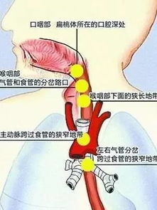 惊险一刻：鱼刺直扎心脏，男子命悬一线的自救与救援