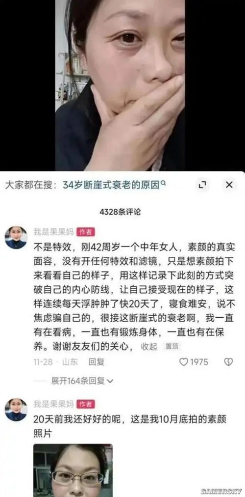 与渐冻症抗争：她用坚强书写生命的意义