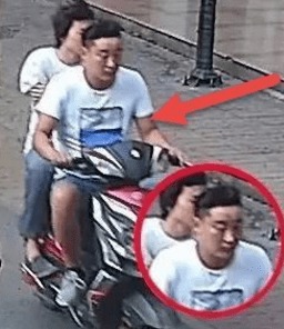 7旬老人贴身捂热水袋竟捂出“蟒蛇纹”：惊险背后的温暖与警示