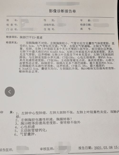 从不吸烟的医学教授确诊肺癌晚期：真相远比想象复杂