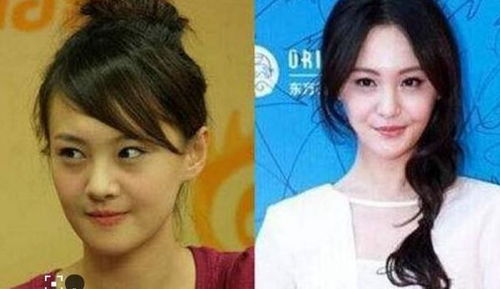 咨询整容的女性